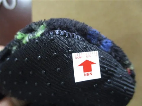 Exposed stitches7 MAJ